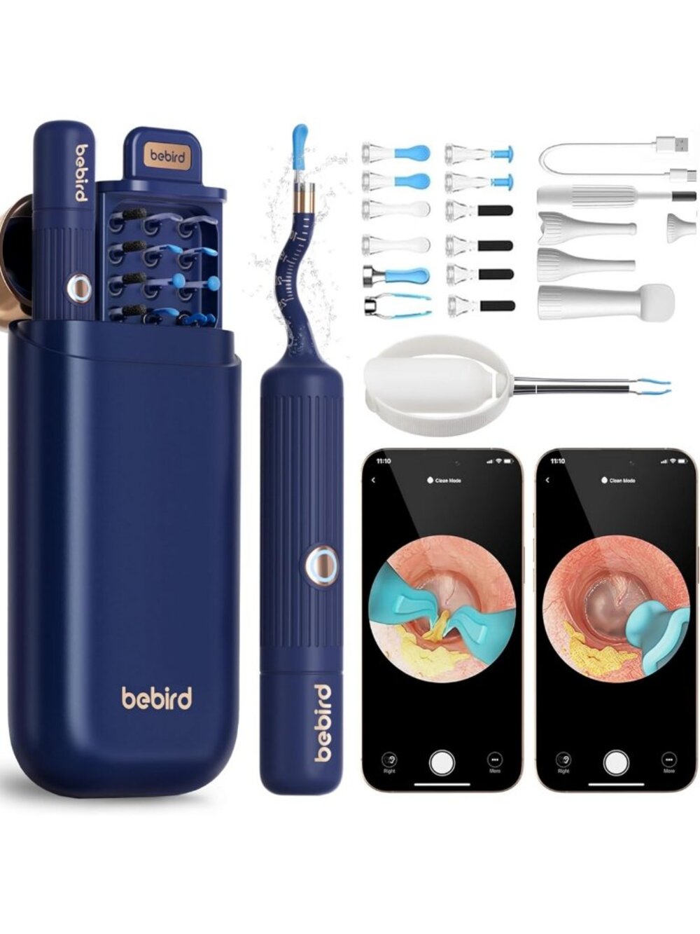 Smart Ear Wax Removal Tool with Camera, HD Otoscope, Gentle Tweezers & 12 Tips